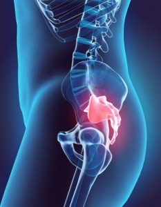 Treating Sciatic Pain With Exercise